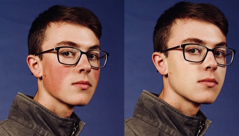 A One-Minute Tutorial on How to Quickly and Effectively Remove Red Skin in Photoshop